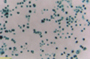 Lentiviral Cell Line